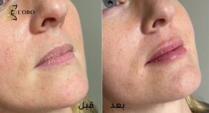 ابر النظارة