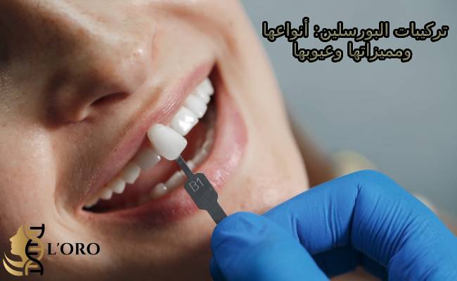 تركيبات البورسلين